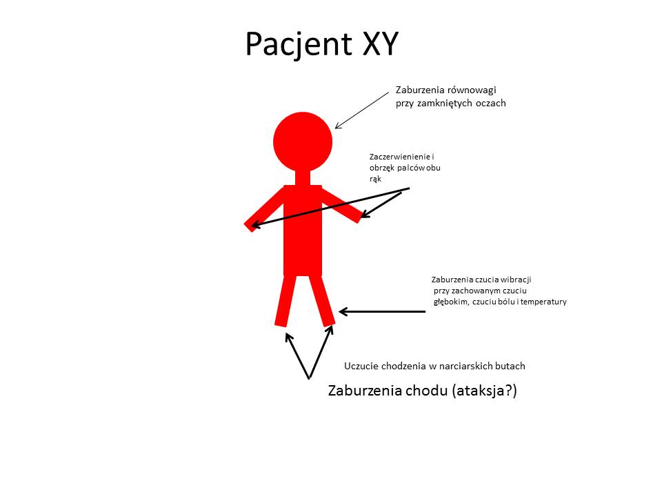 Pacjent XY- objawy neurolog